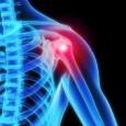 Training Around Powerlifting Injuries While Still Making Progress There is no doubt that perhaps a powerlifters’ worst nightmare is a training-inhibiting injury; namely, the type of asymmetrical “bad pain“ that seems to arise at the worst possible time...